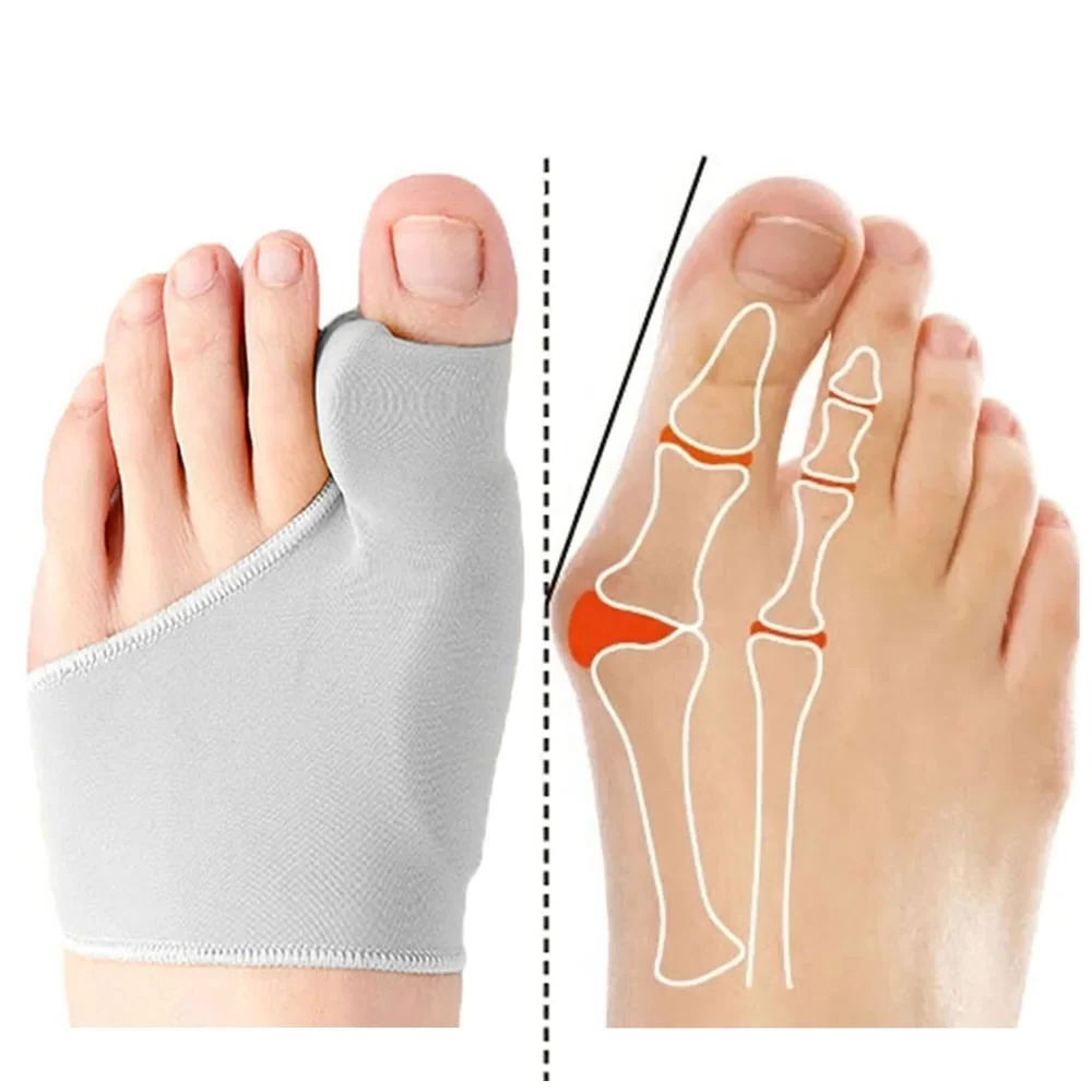 1/2 Paar Zehenspreizer Hallux  – Ankle Brace Sock Bewertung und Preis